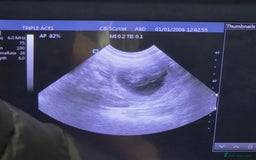 American Bully dogs for sale: Pocket bully puppies - Advert 5