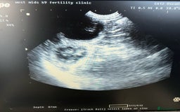 Exotic cats for stud: Exotic Male For Stud in Birmingham - Image 5