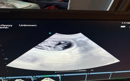 Pointer dogs for sale: Puppies due 20/12 - Advert 6