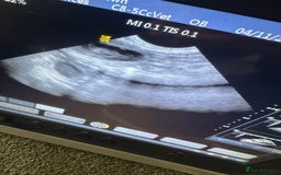 Miniature Poodle dogs for sale: Miniature poodle puppies DUE 8th DEC - Image 8