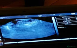 Biewer Terrier dogs for sale: Beautiful Biewer Terrier Pups - Image 4