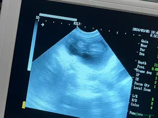 Rottweiler dogs Rottweiler pups due soon - health tested parents - Advert 1