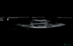 Boxer dogs for sale: Beautiful Boxer Puppies – Due Mid-November - Image 5