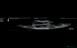 Boxer dogs for sale: Beautiful Boxer Puppies – Due Mid-November - Image 2