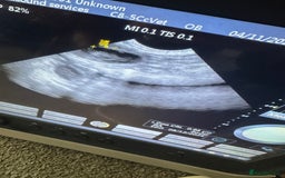 Miniature Poodle dogs for sale: Miniature poodle puppies DUE 8th DEC - Image 11