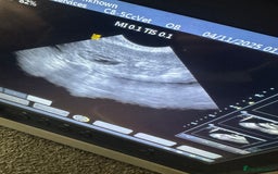 Miniature Poodle dogs for sale: Miniature poodle puppies DUE 8th DEC - Image 10