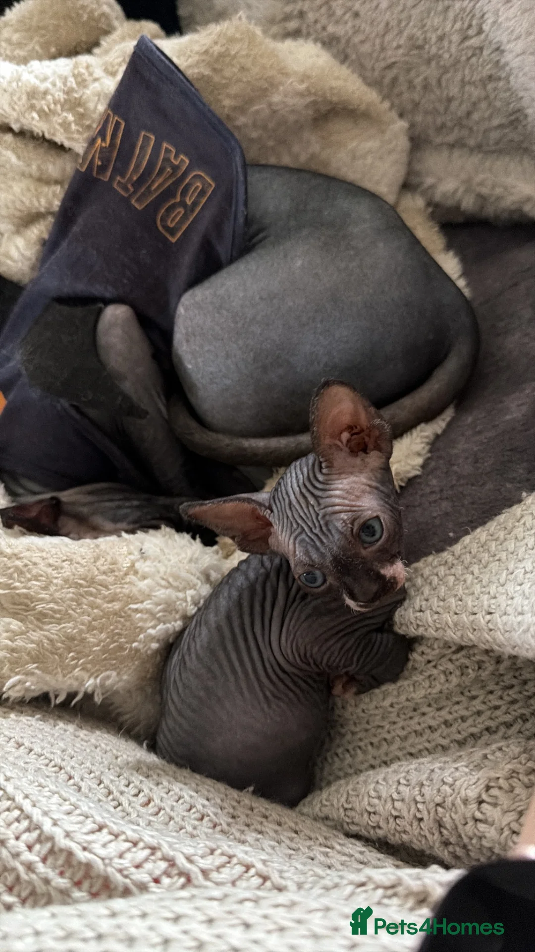 Sphynx cats for sale: 💙🩷4 gorgeous sphynx baby’s 🩷💙 - Advert 12