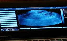 Biewer Terrier dogs for sale: Beautiful Biewer Terrier Pups - Image 6