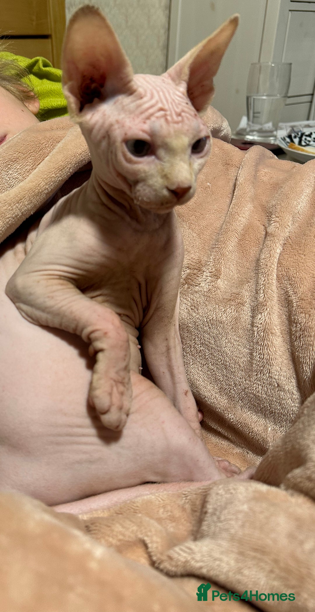 Sphynx cats for sale: Sweet & Sensitive Sphynx Seeks Loving Patient Home - Image 2