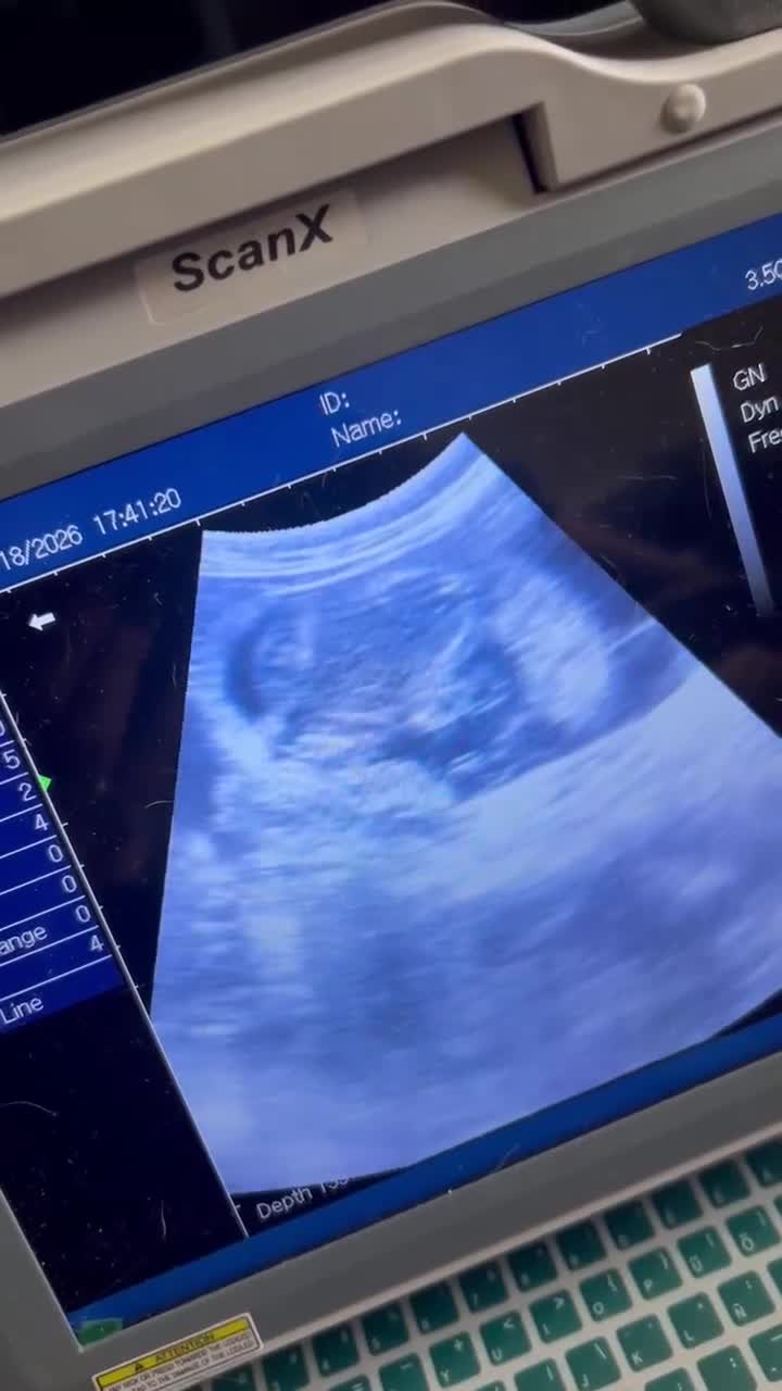 Siberian Husky dogs for stud: BLUE EYED HUSKY FOR STUD - Video 1