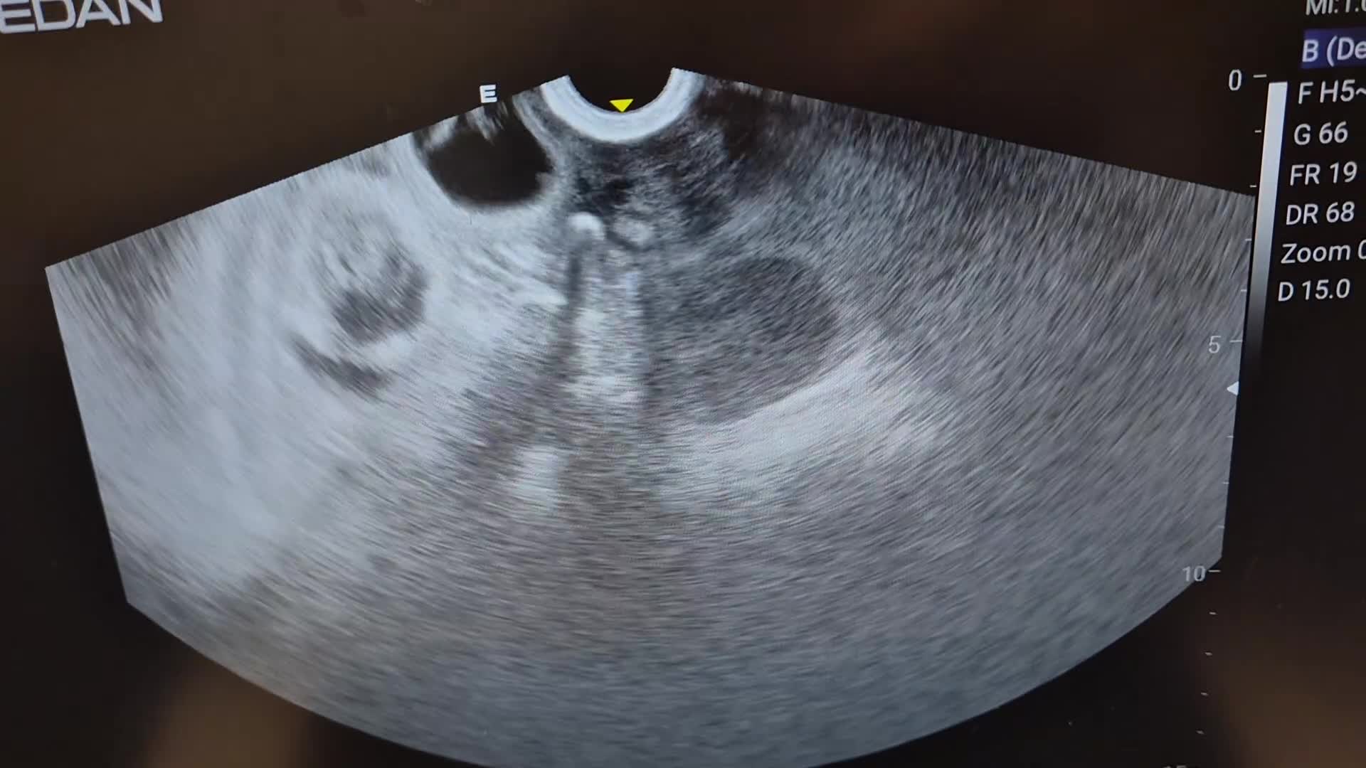 Cocker Spaniel dogs for sale: Show Cockers ~ WAITING LISTS OPENED ~ 2 LITTERS  - Video 2