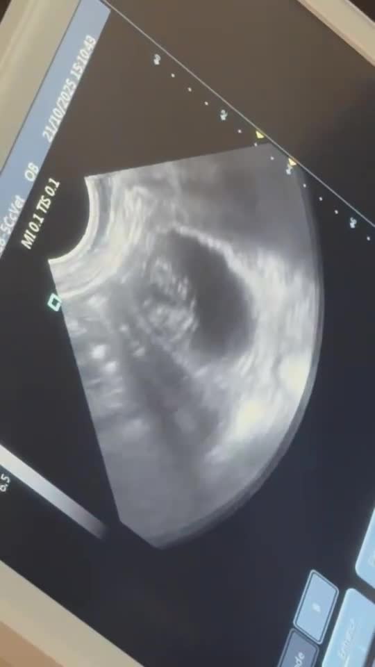 French Bulldog dogs for sale: HIGH QUALITY FLUFFY FRENCHIES  - Video 2