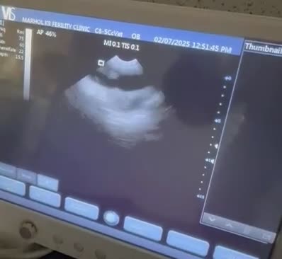 Rottweiler dogs for stud: Rottweiler DNA health tested,,EYE SCANNED  in Wellingborough - Video 2