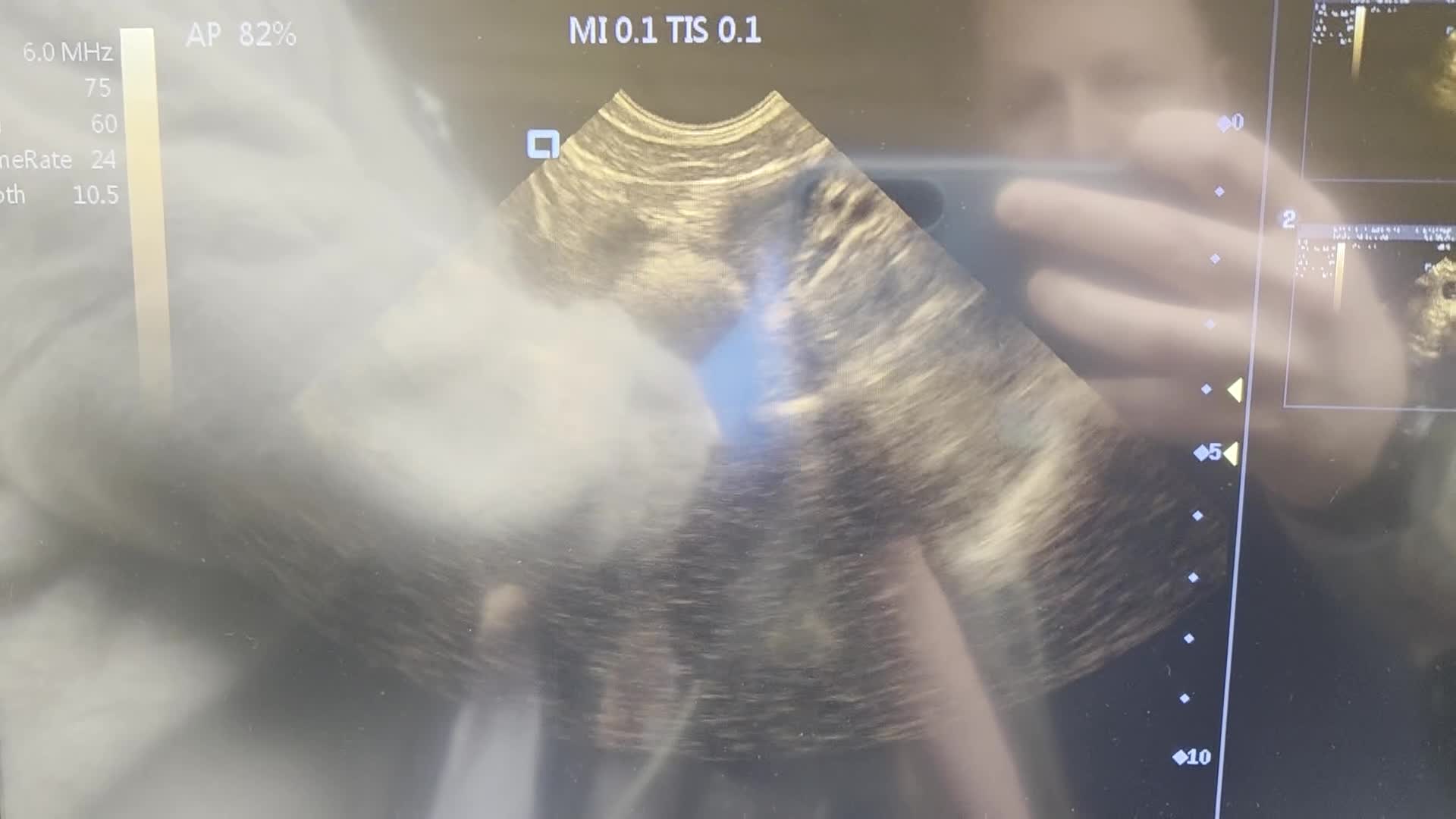 Mixed Breed dogs for sale: Bedlington whippet greyhound pups - Video 1