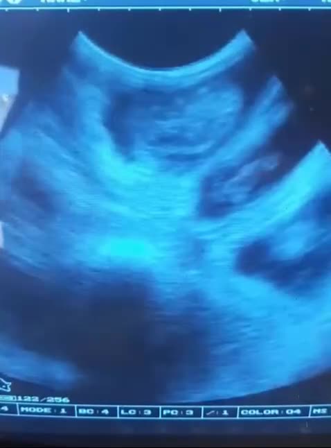 Cockapoo dogs for sale: 🐾 Adorable F1 Cockapoos Ready to Reserve Now! 🐾 in Bedford - Video 1