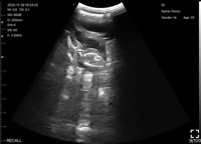 Mixed Breed dogs for sale: The Pug Who Raised a Duck Is Now Expecting Her Own - Video 5