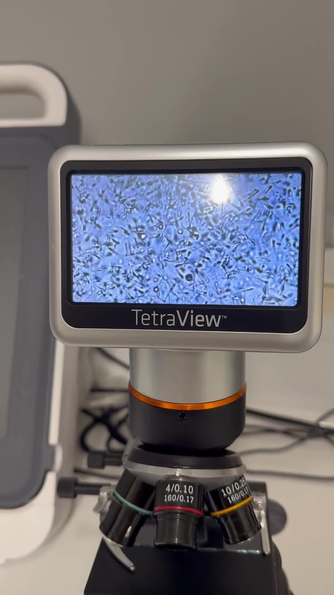 Staffordshire Bull Terrier dogs for stud: Aqua chop SPENCE🩸A SUPERB CH VALGLO BLOODLINE🩸 in Dover - Video 1