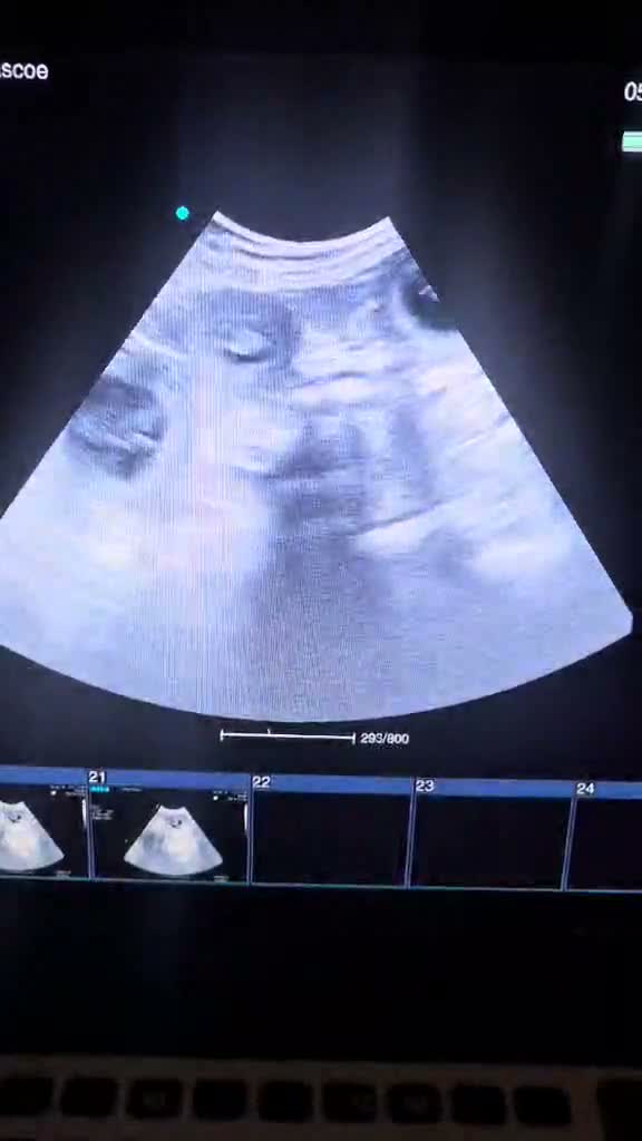 Dachshund dogs for sale: Dotty is pregnant!  - Video 1